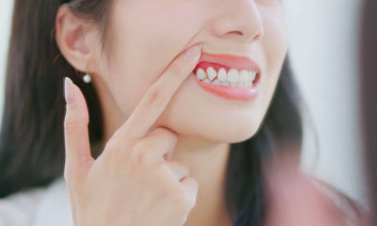 Gum Disease Treatment in Diamond Bar