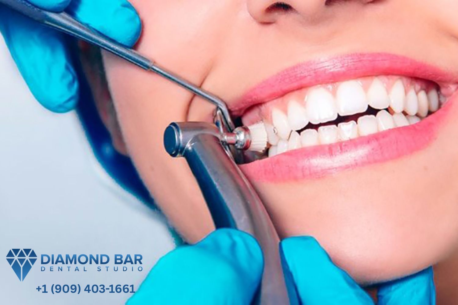 Dentist In Diamond Bar